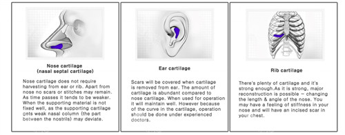 软骨鼻用来获取软骨的部位
