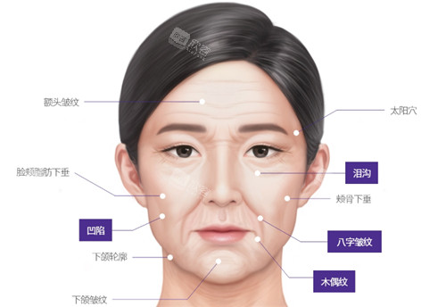 面部衰老的不同症状